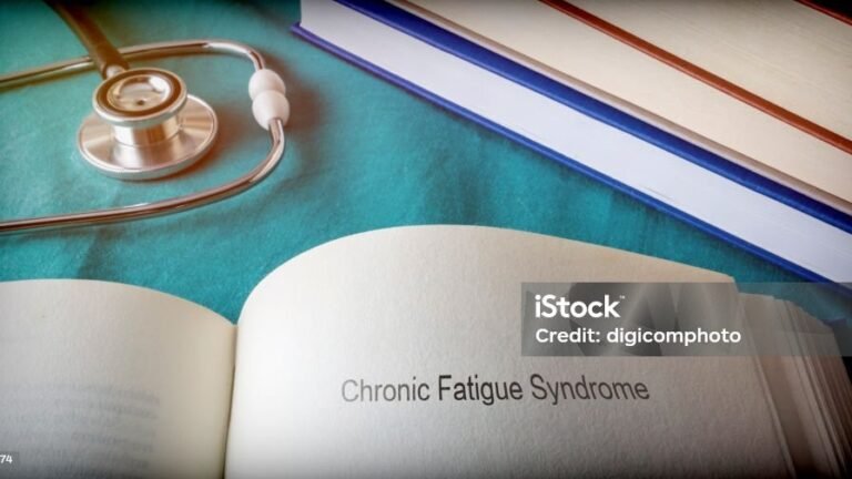Chronic Fatigue Syndrome: Causes, Symptoms & Treatment Tips